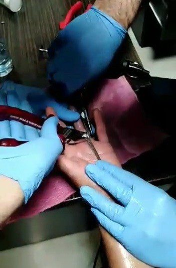 Parmağa Sıkışan Yüzüğü İtfai̇ye Çıkarttı