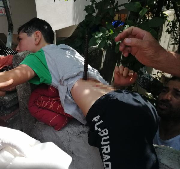 Ağaçtan düşen çocuğa inşaat demiri saplandı