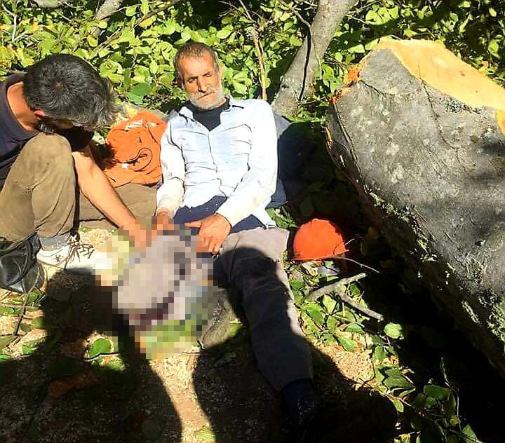 Tomruğun altında kaldı bacağı kesildi