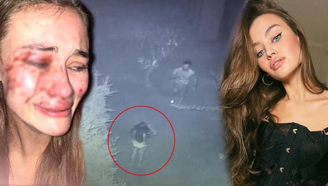 Ukraynalı modele dayakta yeni gelişme