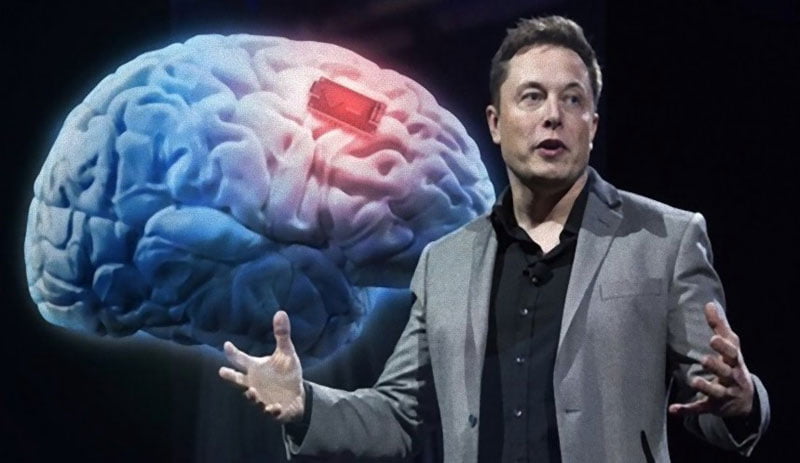 Elon Musk’ın çılgın projesi! İnsan beynine çip takacak