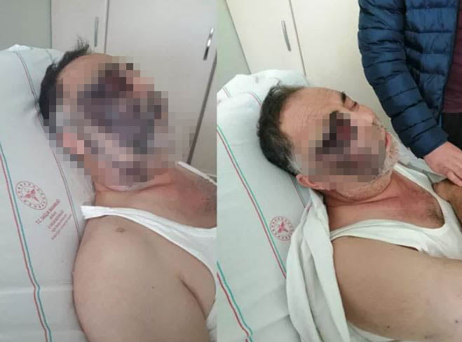 Darbedilen yüzde 90 engelli Mümin Kara yaşamını yitirdi