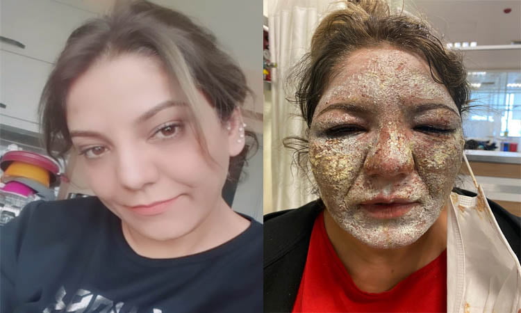 Gittiği güzellik merkezinde kabusu yaşadı