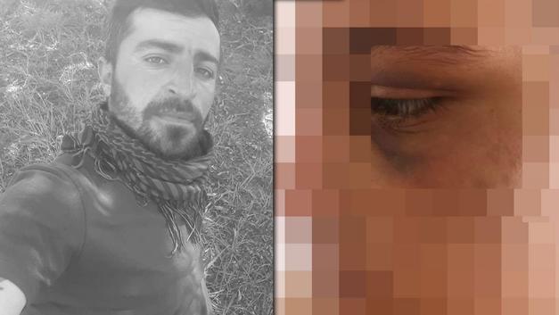Birlikte yaşadığı kadını zincirleyip 6 ay işkence yaptı
