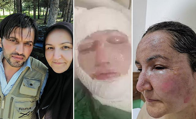 Eşinin kızgın yağ ile yaktığı kadın: Ölmek istemiyorum