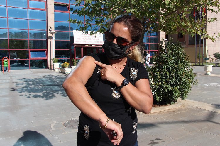 Güzellik merkezinde kolları ve bacakları yandı