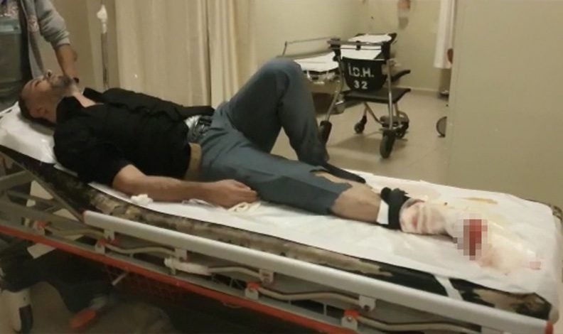Bursa’da sokak ortasında bacağından vuruldu