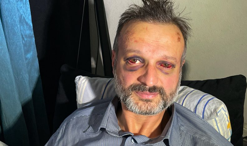 Bursa’da müzisyene darp olayında yeni gelişme