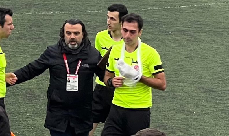 Sakatlanan hakem elinde bandajla maçı yönetti