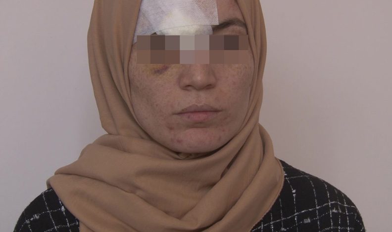 4 yıldır eşinden şiddet gören kadın hastanelik oldu