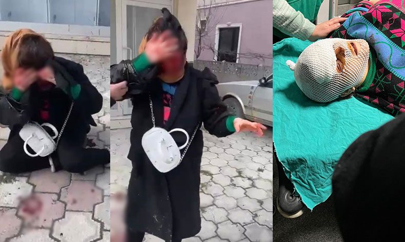 Barışma teklifini reddedince hastanelik oldu