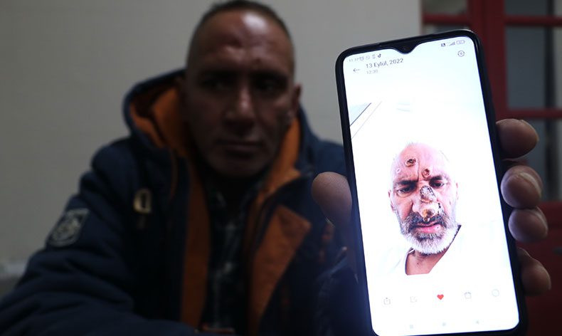 Sinek ısırığıyıla hayatının şokunu yaşadı