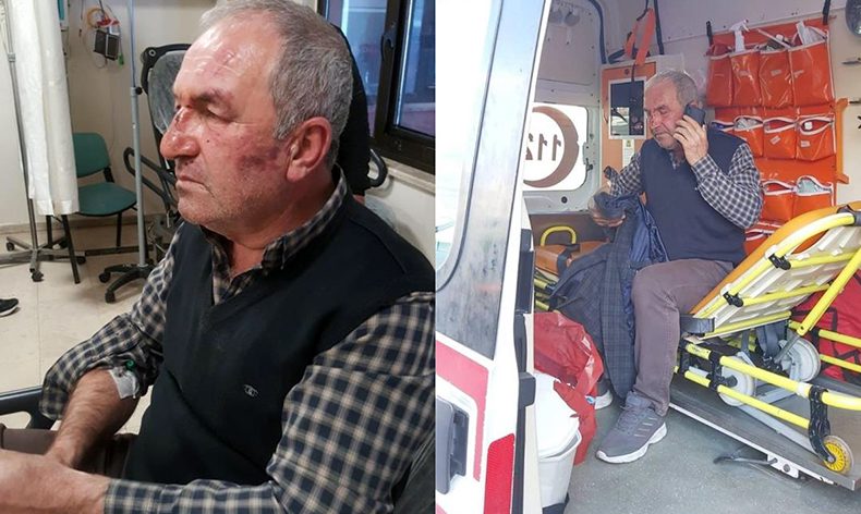 Kulak zarını patlatana kadar dövdüler