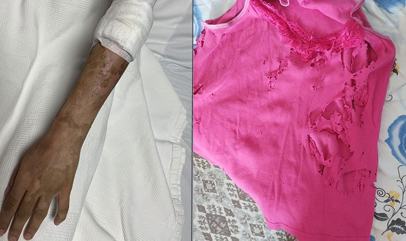 Lavabo açıcı bomba gibi patladı