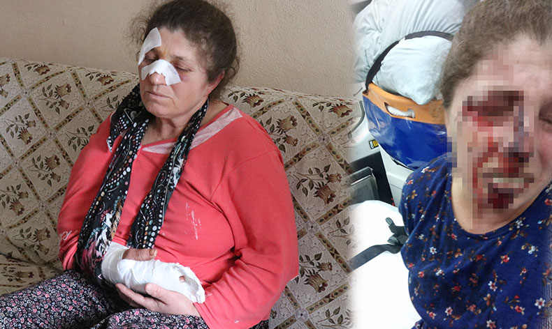 Kavgayı ayırmaya çalışırken darp edildi