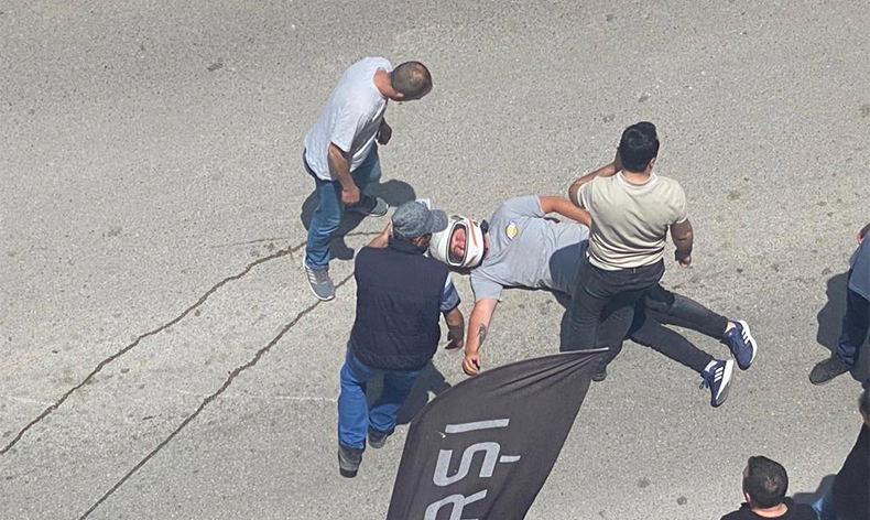 Otomobil ile çarpışan motosiklet sürücüsü yaralandı