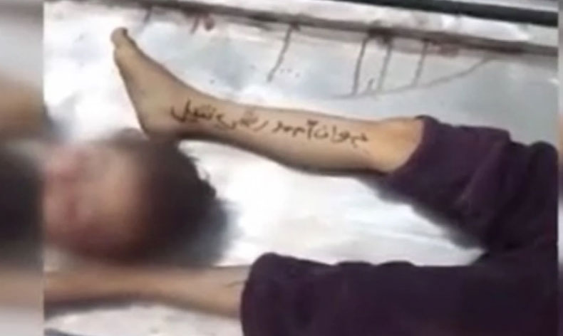 Saldırılarda hayatını kaybeden çocukların kimlikleri kollarına yazılıyor