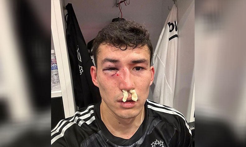 Beşiktaş: “Zaynutdinov’un burnunda ve göz çukurunda kırık saptanmıştır”