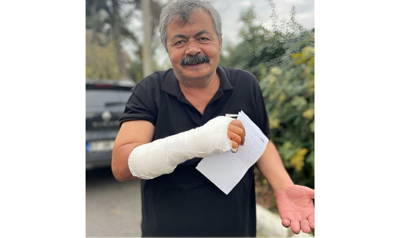Kedilerin kavgasını ayırırken arada kaynadı