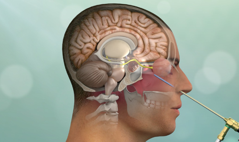 Hipofiz adenomları görme kaybı oluşturabilir