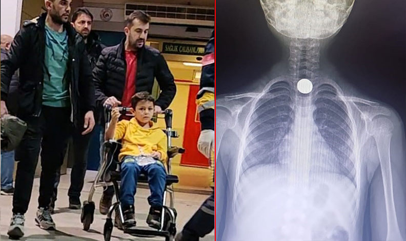 Bursa’da 7 yaşındaki çocuk madeni para yuttu