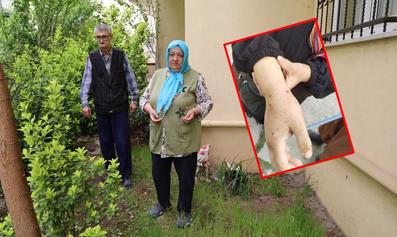 Sokak köpeklerinin saldırısına uğradı