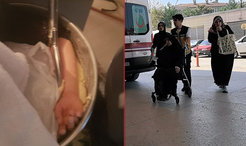 Bursa’da bir kadın kolunu hamur makinesine kaptırdı